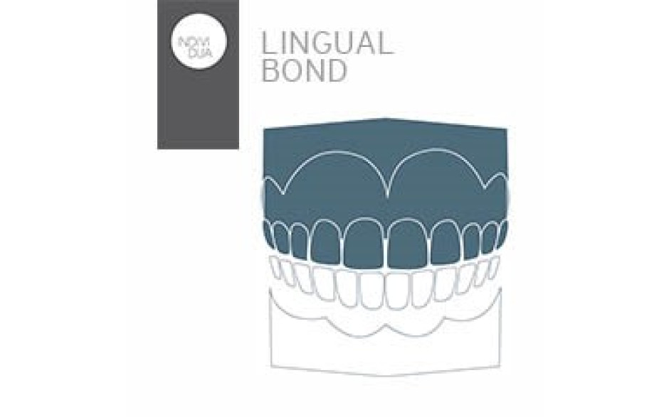 INDIVIDUA Lingual Bond OK